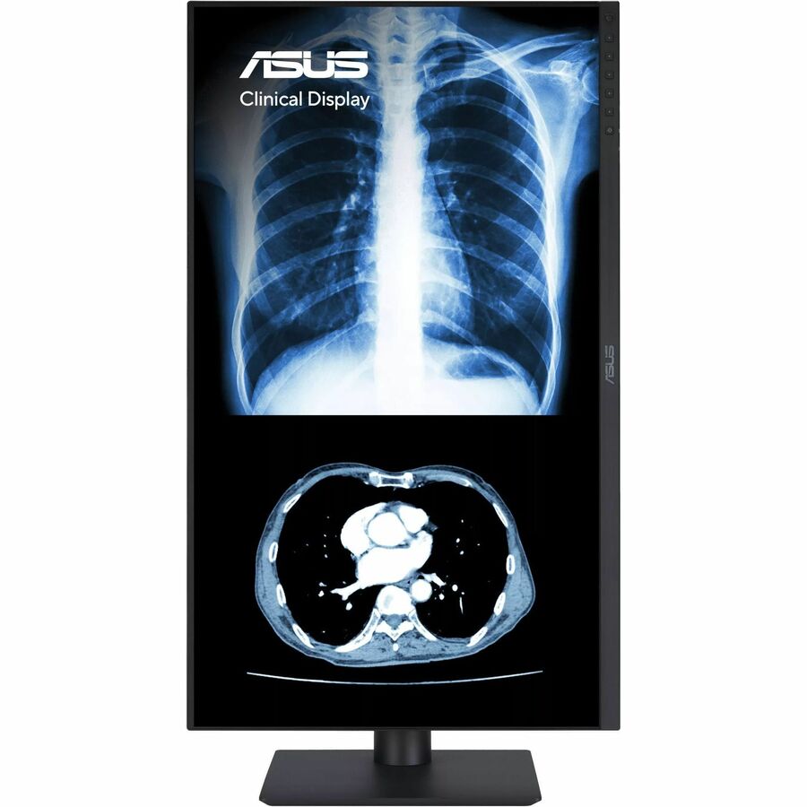 ASUS 27 1440P USBC Clinical Monitor MH2741A 3.6MP 2560 x 1440, AGLR, DICOM Part 14 GSDF, DICOM Preset, Auto Calibration, JND < 10, DisplayPort Daisychain,