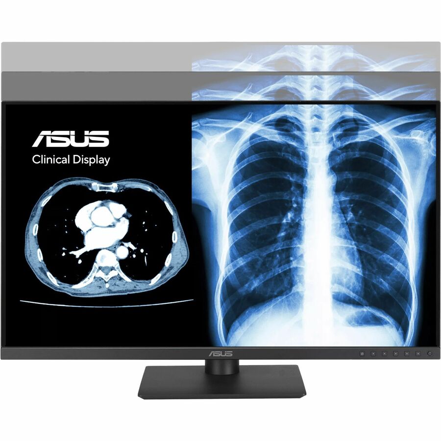 ASUS 27 1440P USBC Clinical Monitor MH2741A 3.6MP 2560 x 1440, AGLR, DICOM Part 14 GSDF, DICOM Preset, Auto Calibration, JND < 10, DisplayPort Daisychain,